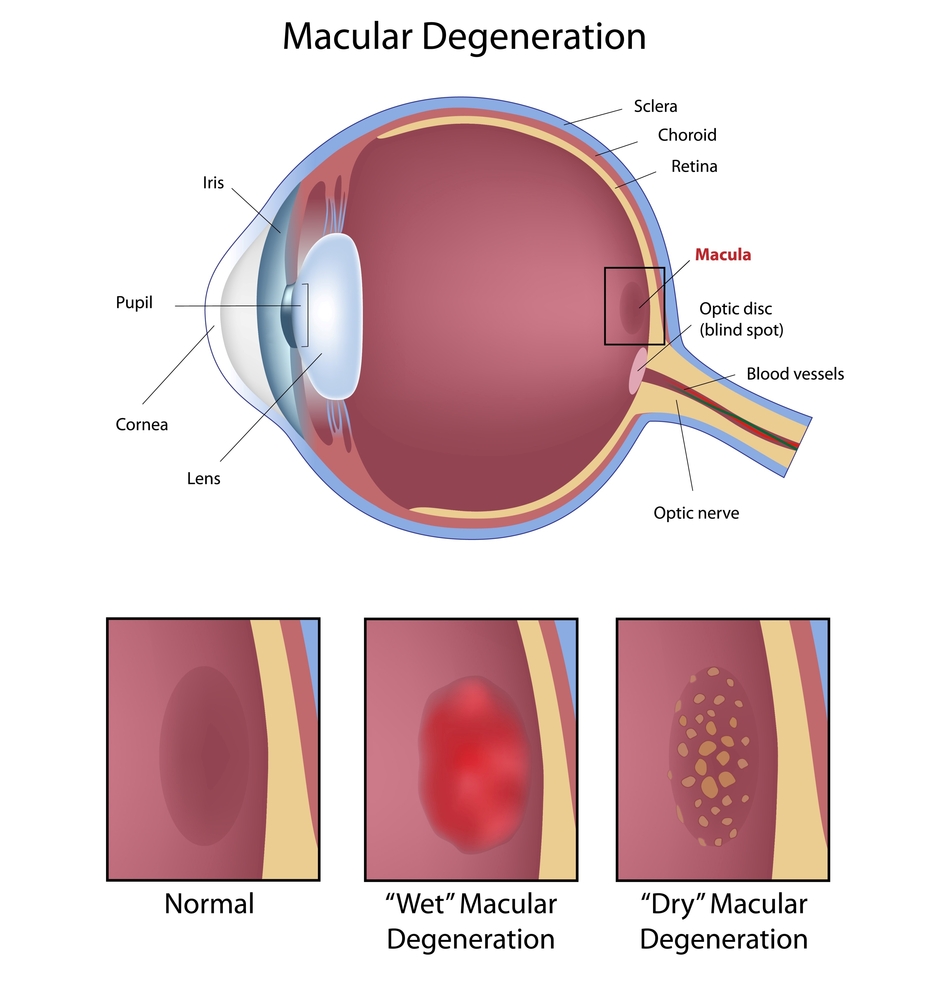 AMD diagram.jpg